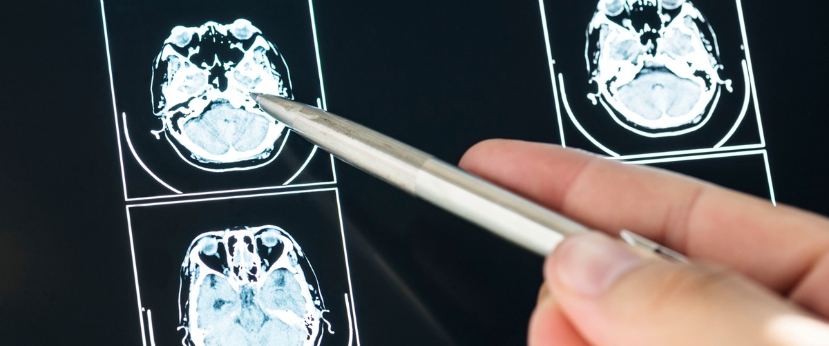 Cobertura, pruebas y opiniones de Radiología Adeslas: todo lo que necesitas saber para tu salud.