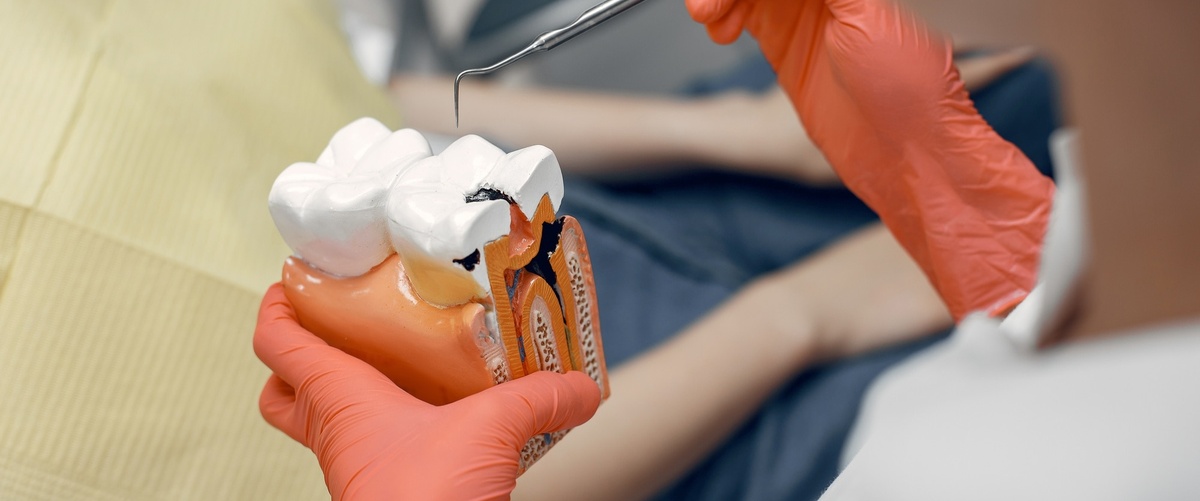Coberturas y tarifas de tratamientos dentales en Sanitas Dental 21 1